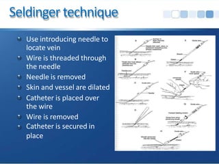 Seldinger technique
Use introducing needle to
locate vein
Wire is threaded through
the needle
Needle is removed
Skin and vessel are dilated
Catheter is placed over
the wire
Wire is removed
Catheter is secured in
place
 