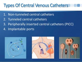 Types Of Central Venous Catheters
1. Non-tunneled central catheters
2. Tunneled central catheters
3. Peripherally inserted central catheters (PICC)
4. Implantable ports
 