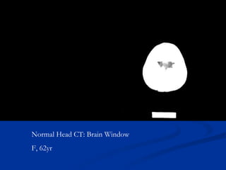 Central nervous system | PPT