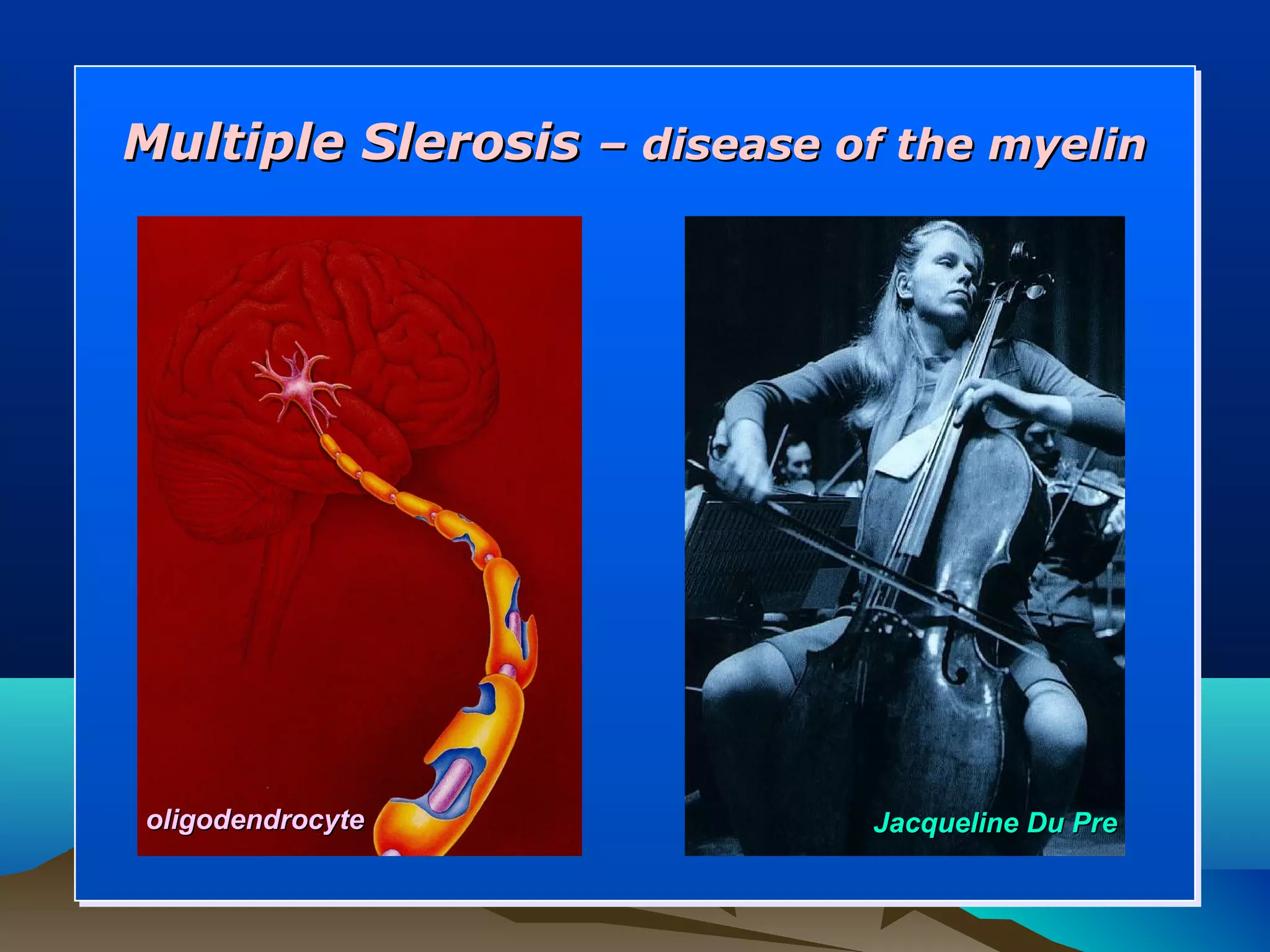 Multiple Slerosis – disease of the myelin




oligodendrocyte              Jacqueline Du Pre
 