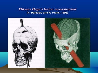 Phineas Gage’s lesion reconstructed
    (H. Damasio and R. Frank, 1992)
 