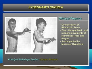 SYDENHAM’S CHOREA
                 SYDENHAM’S CHOREA


                                               Clinical Feature
                                                - Complication of
                                                  Rheumatic Fever
                                                - Fine, disorganized , and
                                                  random movements of
                                                  extremities, face and
                                                  tongue
                                                - Accompanied by
                                                  Muscular Hypotonia
                                                -




Principal Pathologic Lesion: Corpus Striatum
 