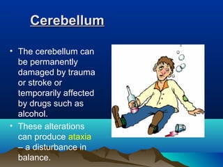 Cerebellum

• The cerebellum can
  be permanently
  damaged by trauma
  or stroke or
  temporarily affected
  by drugs such as
  alcohol.
• These alterations
  can produce ataxia
  – a disturbance in
  balance.
 