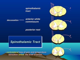spinothalamic
                     tract



 decussation
                     anterior white
                     commissure


                     posterior root




     Spinothalamic Tract
     Spinothalamic Tract


- contralateral loss of pain and temperature
    sensation below the level of lesion
 