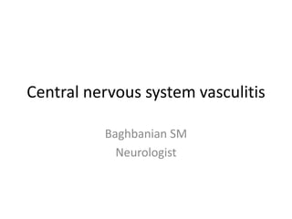 Central nervous system vasculitis
Baghbanian SM
Neurologist
 