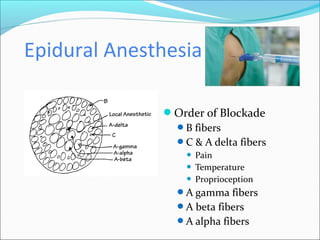 Epidural Anesthesia
Order of Blockade
B fibers
C & A delta fibers
 Pain
 Temperature
 Proprioception
A gamma fibers
A beta fibers
A alpha fibers
 