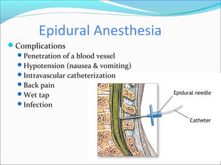 Epidural Anesthesia
Complications
Penetration of a blood vessel
Hypotension (nausea & vomiting)
Intravascular catheterization
Back pain
Wet tap
Infection
 