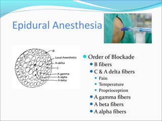 Epidural Anesthesia
Distances from Skin to Epidural Space
Average adult: 4-6cm
Obese adult: up to 8cm
Thin adult: 3cm
...