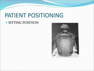 PATIENT POSITIONING
 SITTING POSITION
 
