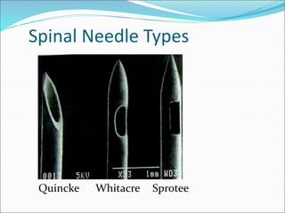 Spinal Needle Types
Quincke Whitacre Sprotee
 