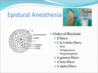Epidural Anesthesia
 Order of Blockade
 B fibers
 C & A delta fibers
 Pain
 Temperature
 Proprioception
 A gamma fibers
 A beta fibers
 A alpha fibers
 