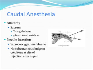 Caudal Anesthesia
 Anatomy
 Sacrum
 Triangular bone
 5 fused sacral vertebrae
 Needle Insertion
 Sacrococcygeal membrane
 No subcutaneous bulge or
crepitous at site of
injection after 2-3ml
 
