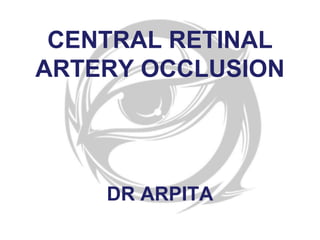 CENTRAL RETINAL
ARTERY OCCLUSION
DR ARPITA
 