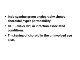 Central serous chorioretinopathy | PPTX