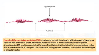 Mixed Apnea Example Comprehensive Overview of Central and Mixed Sleep Apnea: Diagnosis ...