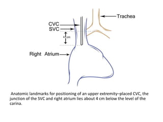 Central Venous Access.pptx
