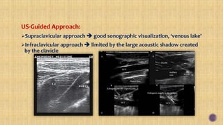 US-Guided Approach:
Supraclavicular approach  good sonographic visualization, ‘venous lake’
Infraclavicular approach  limited by the large acoustic shadow created
by the clavicle
 