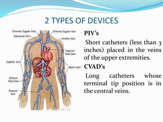 Central venous access catheter | PPT