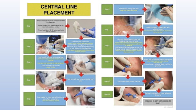 Central Line Indication Algorithm Central venous access devices all you need to know | PPTX