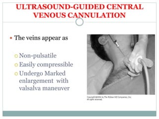 ULTRASOUND-GUIDED CENTRAL
VENOUS CANNULATION
 The veins appear as
 Non-pulsatile
 Easily compressible
 Undergo Marked
enlargement with
valsalva maneuver
 
