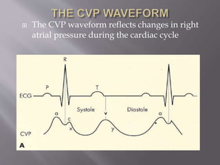 centralvenouscatheter-1.pdf