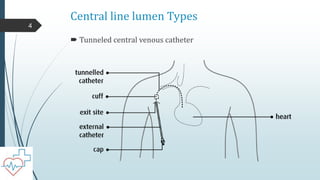 Central line lumen Types
 Tunneled central venous catheter
4
 