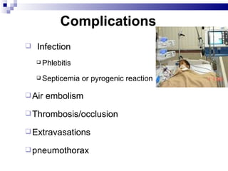 Complications
   Infection
     Phlebitis


     Septicemia   or pyrogenic reaction

 Air   embolism
 Thrombosis/occlusion

 Extravasations

 pneumothorax
 
