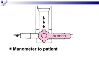    Manometer to patient
 