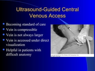 Ultrasound-Guided CentralUltrasound-Guided Central
Venous AccessVenous Access
 Becoming standard of care
 Vein is compressible
 Vein is not always larger
 Vein is accessed under direct
visualization
 Helpful in patients with
difficult anatomy
 