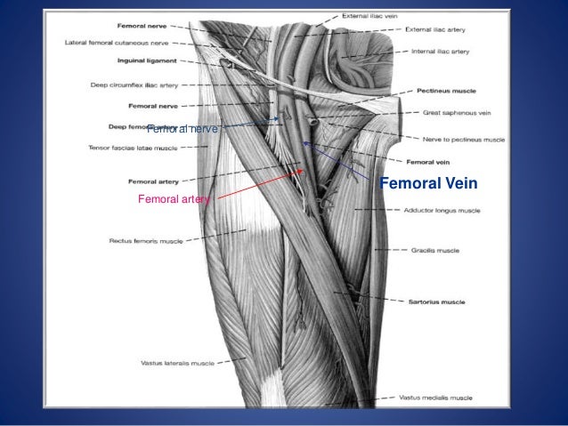 central venous catheterization cv line