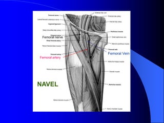 Femoral artery
Femoral nerve
Femoral Vein
NAVEL
 
