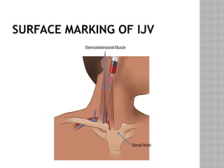 SURFACE MARKING OF IJV
 
