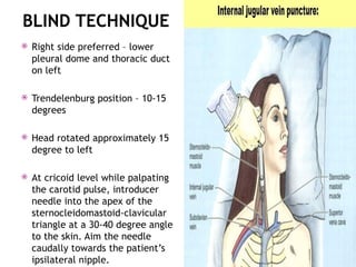 BLIND TECHNIQUE
 Right side preferred – lower
pleural dome and thoracic duct
on left
 Trendelenburg position – 10-15
degrees
 Head rotated approximately 15
degree to left
 At cricoid level while palpating
the carotid pulse, introducer
needle into the apex of the
sternocleidomastoid-clavicular
triangle at a 30-40 degree angle
to the skin. Aim the needle
caudally towards the patient’s
ipsilateral nipple.
 