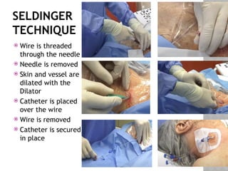 SELDINGER
TECHNIQUE
 Wire is threaded
through the needle
 Needle is removed
 Skin and vessel are
dilated with the
Dilator
 Catheter is placed
over the wire
 Wire is removed
 Catheter is secured
in place
 