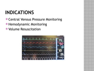 INDICATIONS
 Central Venous Pressure Monitoring
 Hemodynamic Monitoring
 Volume Resuscitation
 