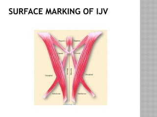 SURFACE MARKING OF IJV
 