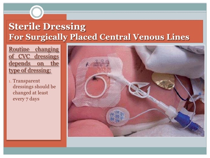 Precautions for Central Venous Catheters in Neonates