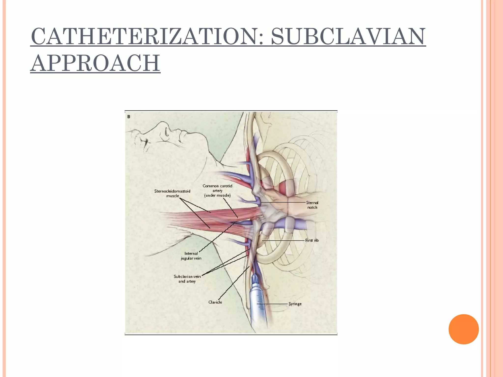 CATHETERIZATION: SUBCLAVIAN
APPROACH
 