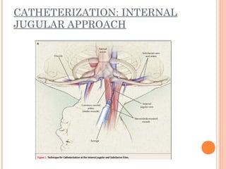CATHETERIZATION: INTERNAL
JUGULAR APPROACH
 