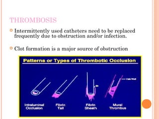 THROMBOSIS
 Intermittently used catheters need to be replaced
frequently due to obstruction and/or infection.
 Clot formation is a major source of obstruction
 