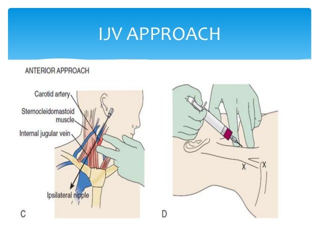 central venous pressure