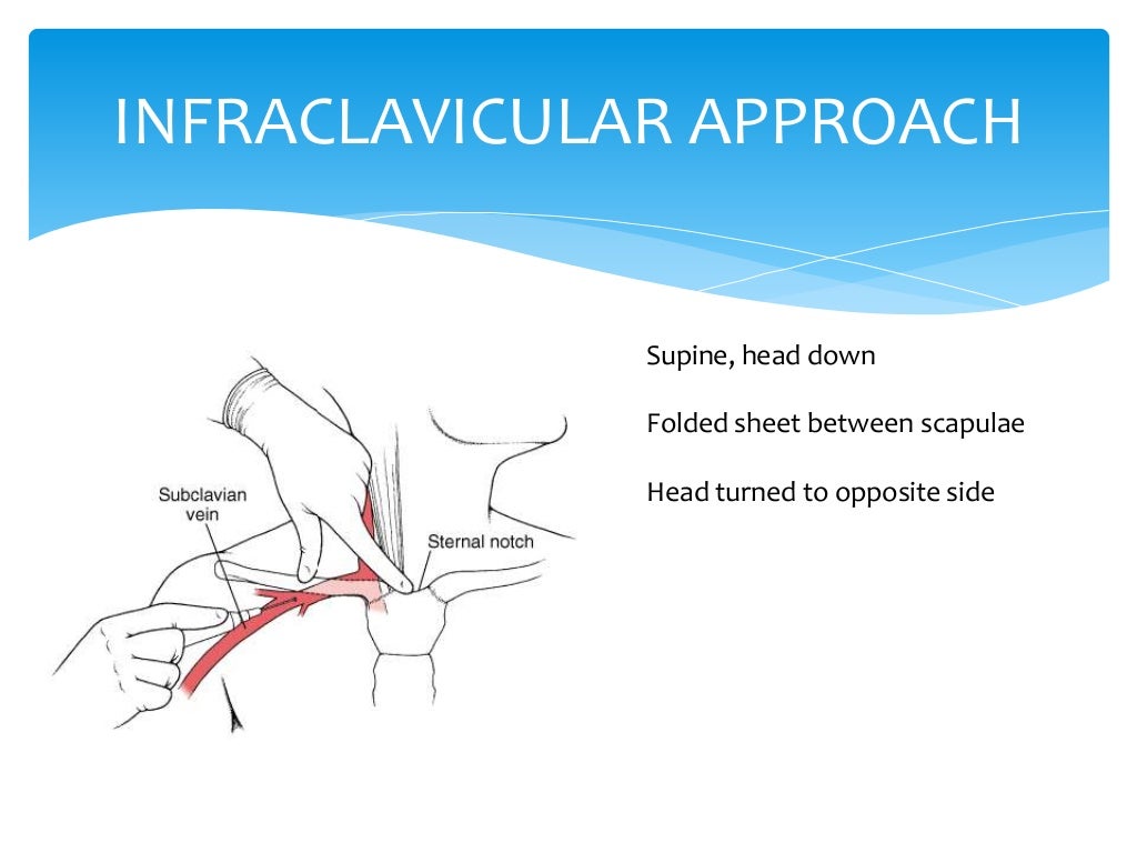 Central venous pressure