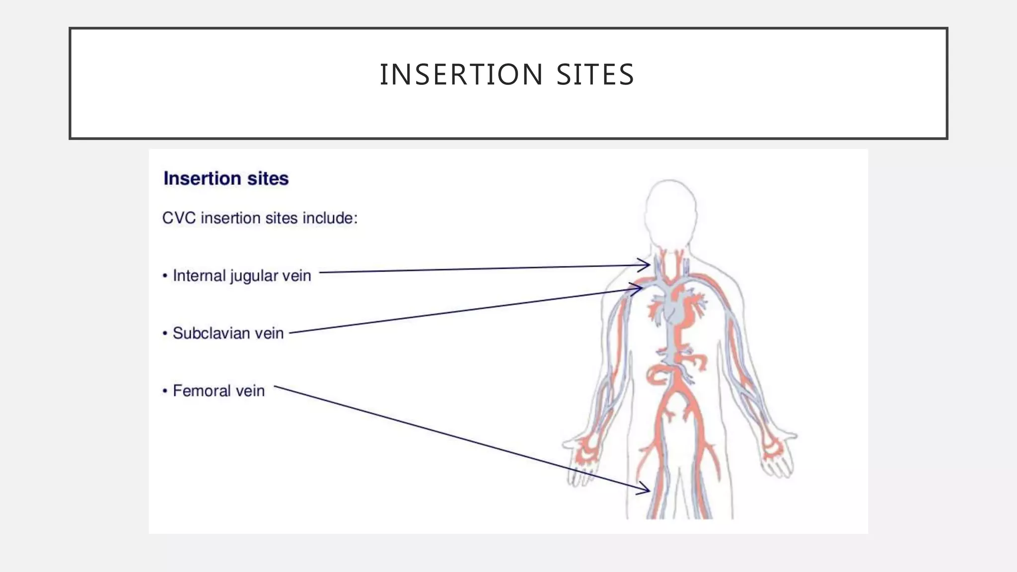 central-venous-pressure-monitoring-pptx