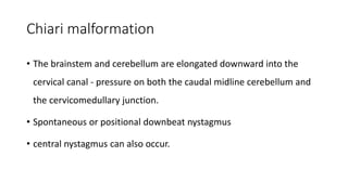 Chiari malformation
• The brainstem and cerebellum are elongated downward into the
cervical canal - pressure on both the caudal midline cerebellum and
the cervicomedullary junction.
• Spontaneous or positional downbeat nystagmus
• central nystagmus can also occur.
 