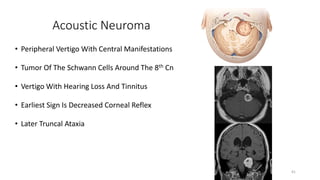 Acoustic Neuroma
• Peripheral Vertigo With Central Manifestations
• Tumor Of The Schwann Cells Around The 8th Cn
• Vertigo With Hearing Loss And Tinnitus
• Earliest Sign Is Decreased Corneal Reflex
• Later Truncal Ataxia
41
 