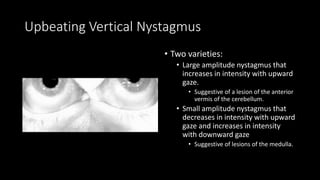 Upbeating Vertical Nystagmus
• Two varieties:
• Large amplitude nystagmus that
increases in intensity with upward
gaze.
• Suggestive of a lesion of the anterior
vermis of the cerebellum.
• Small amplitude nystagmus that
decreases in intensity with upward
gaze and increases in intensity
with downward gaze
• Suggestive of lesions of the medulla.
 