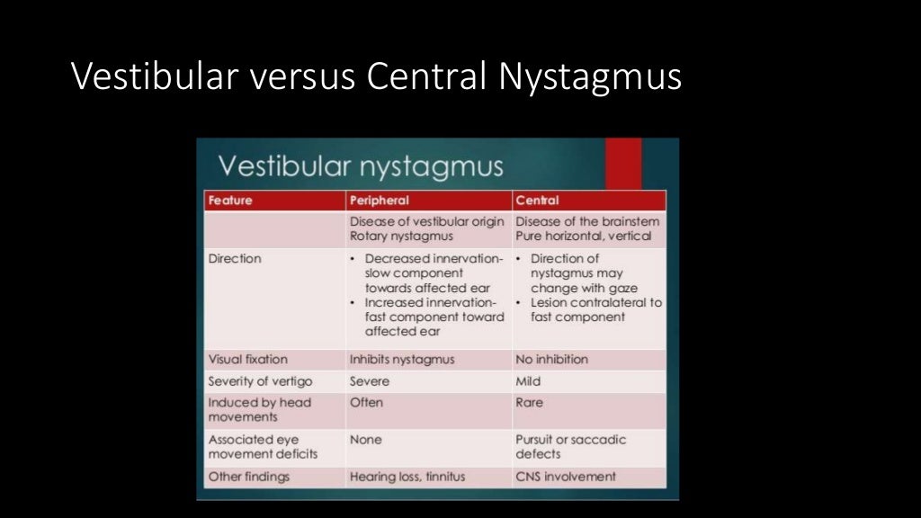Central vertigo and nystagmus