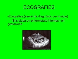 ECOGRAFIES - Ecografies:(servei de diagnòstic per imatge) -Ens ajuda en enfermetats internes i en gestacions  