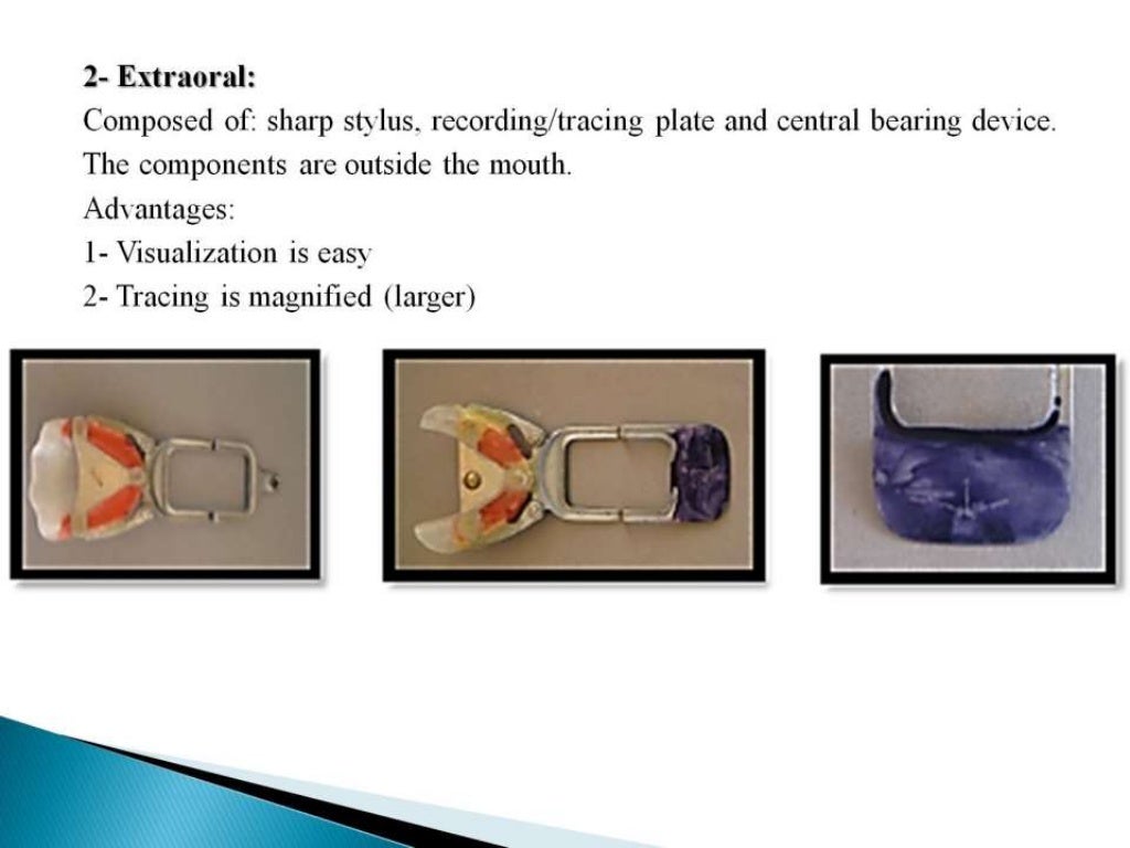 Centric and eccentric record in complete denture 3rd yr