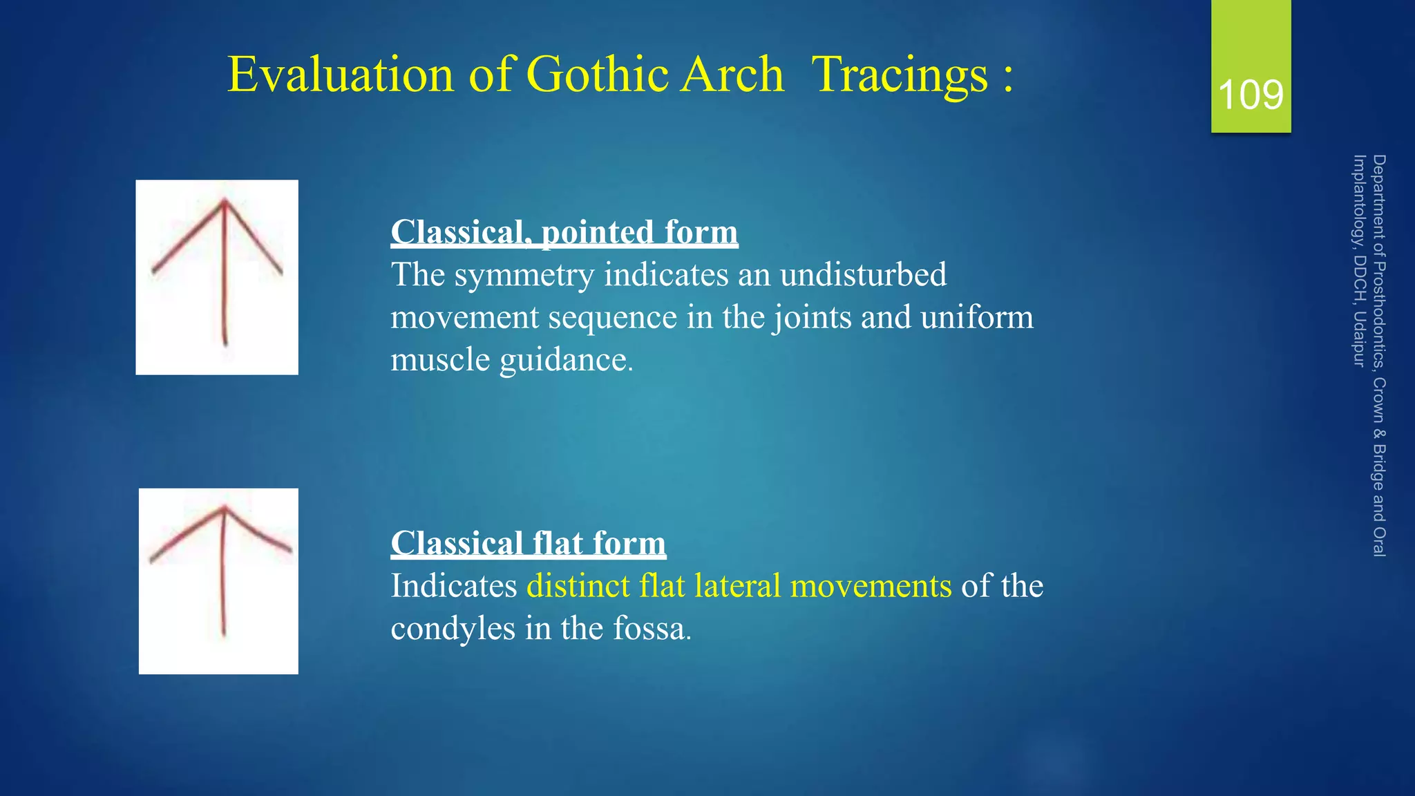 Evaluation of Gothic Arch Tracings : 109
Classical, pointed form
The symmetry indicates an undisturbed
movement sequence in the joints and uniform
muscle guidance.
Classical flat form
Indicates distinct flat lateral movements of the
condyles in the fossa.
 